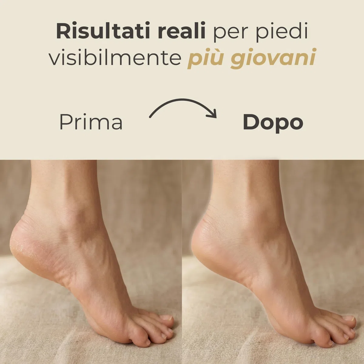 NYV Sérum Activo Regenerador y Reparador de Pies Antiedad con Acetyl Hexapeptide-8 y Diamante Coloidal - Baba de Caracol, Ácido Hialurónico y Niacinamida - Cuidado de Pies Premium Italiano - 50 ml