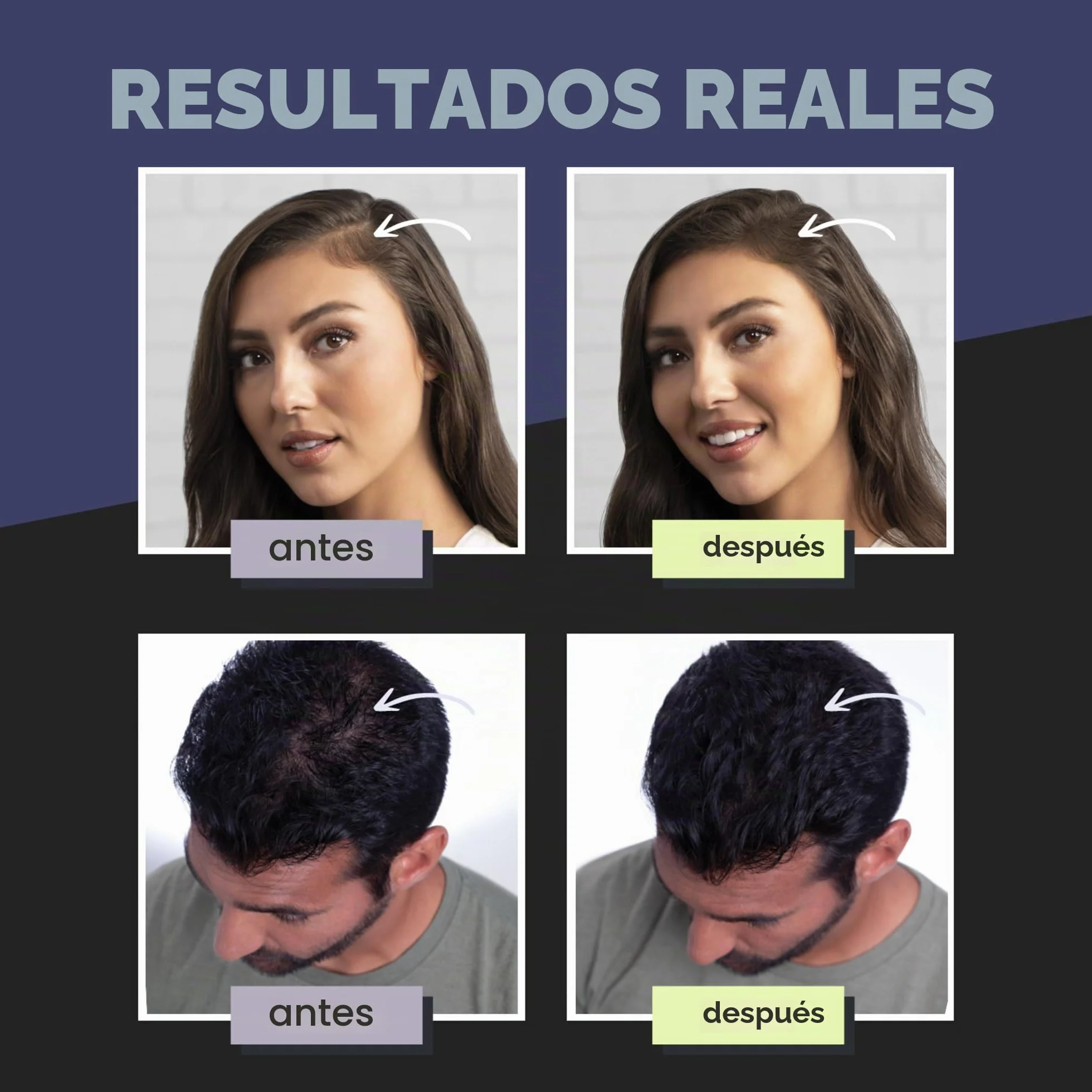 TOPPIK Fibras Capilares Castaño Oscuro, Fibras de Queratina para Crear más Densidad en el Cabello de Forma Inmediata, 12 g, Marrón Oscuro (TPD12A), Adultos unisex