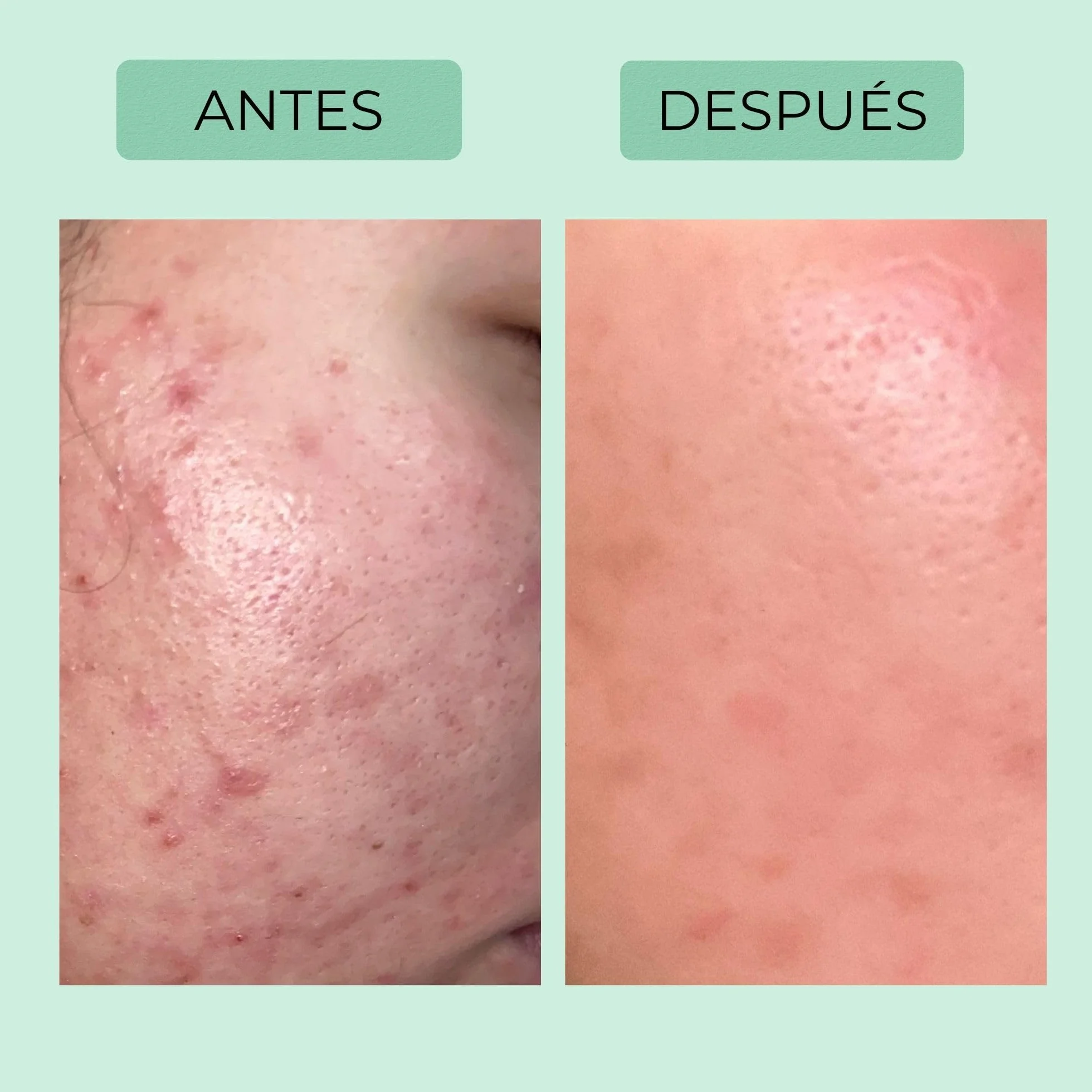 Afrodita Professional Niacinamida Gel limpiador para pieles grasas y mixtas, limpiador facial suave con ácido hialurónico, limpieza profunda de poros, 94% de origen natural, sin alcohol ni sulfatos