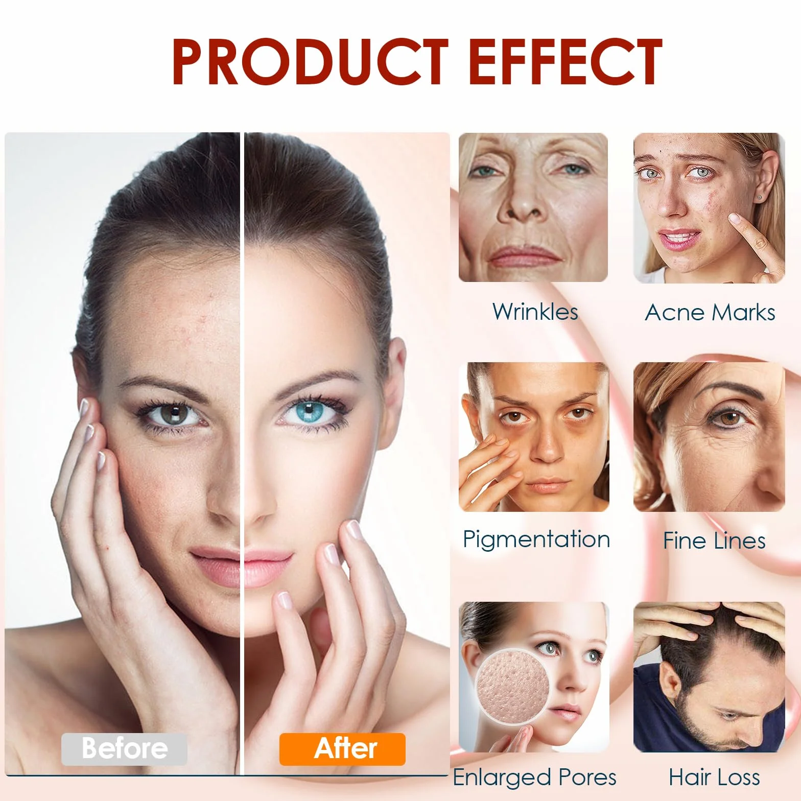 30 Pcs de Cartuchos de Repuesto de 36 Pin para Pluma de Microneedling Dr.pen Modelo M7/M5/N2/E30, Consejos de Micropunción Desechables Auténticos, Accesorio para Pluma Microneedle(36 Pin, 30Pcs)